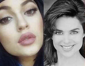 Seven celebrities who have got it right with cosmetic surgery